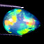 1.51 ct Impressive Pear Cabochon (10.84 x 7.67 mm) Rainbow Opal Gemstone